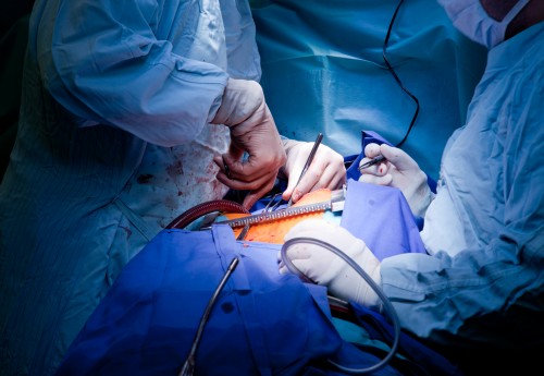 Operace srdce/ilustrační foto