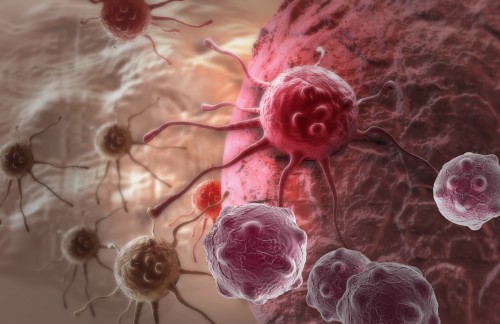 Rakovina/ilustrační foto