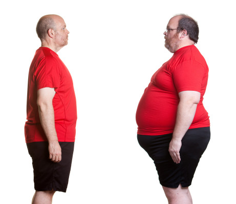Obezita/ilustrační foto