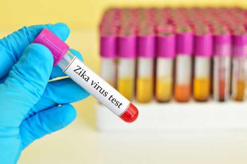 Test na virus zika/ilustr. foto